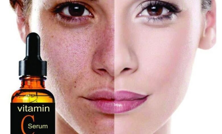 C vitamini serumu ne işe yarar? Kullananların yorumları 1 C vitamini serumu ne işe yarar? Kullananların yorumları