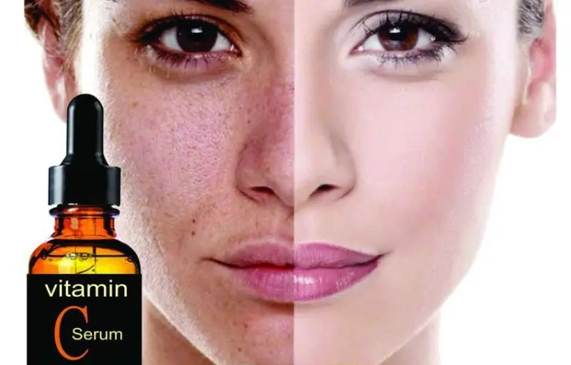 C vitamini serumu ne işe yarar? Kullananların yorumları 22 C vitamini serumu ne işe yarar? Kullananların yorumları
