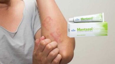 Mantazol krem vajinal mantara, pişiğe, egzamaya iyi gelir mi?