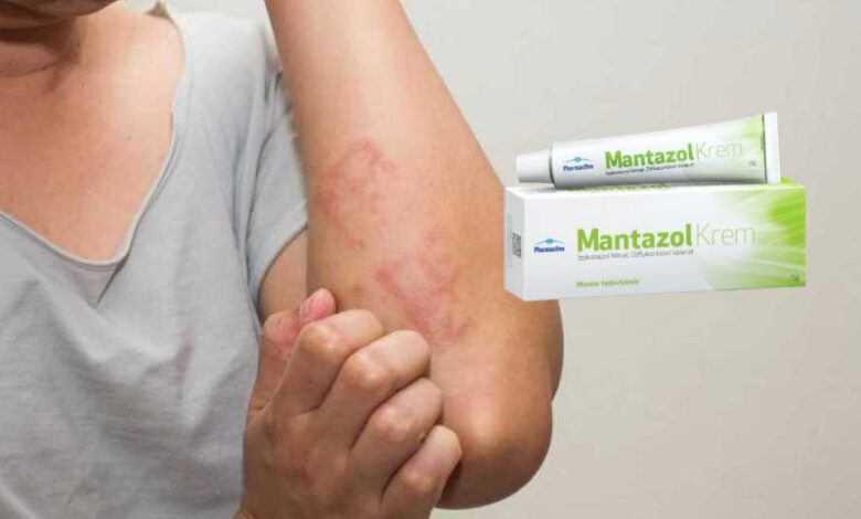 Mantazol krem vajinal mantara, pişiğe, egzamaya iyi gelir mi? 1 Mantazol krem vajinal mantara, pişiğe, egzamaya iyi gelir mi?