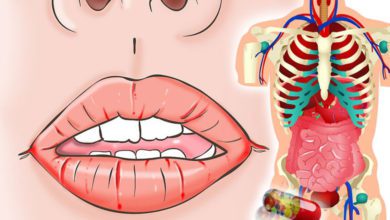 Hangi vitamin eksikliği hangi belirtileri verir?