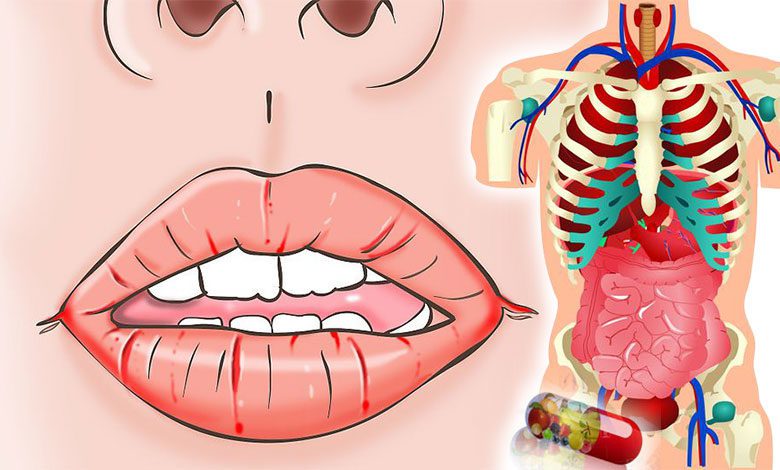 Hangi vitamin eksikliği hangi belirtileri verir? 1 Hangi vitamin eksikliği hangi belirtileri verir?