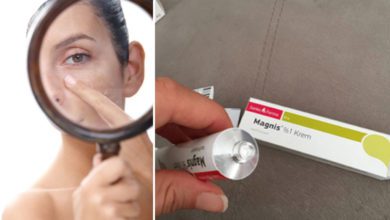 Magnis krem siyah noktalara, egzamaya iyi gelir mi?