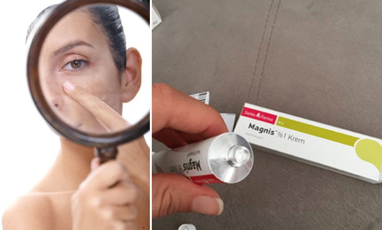 Magnis krem siyah noktalara, egzamaya iyi gelir mi?