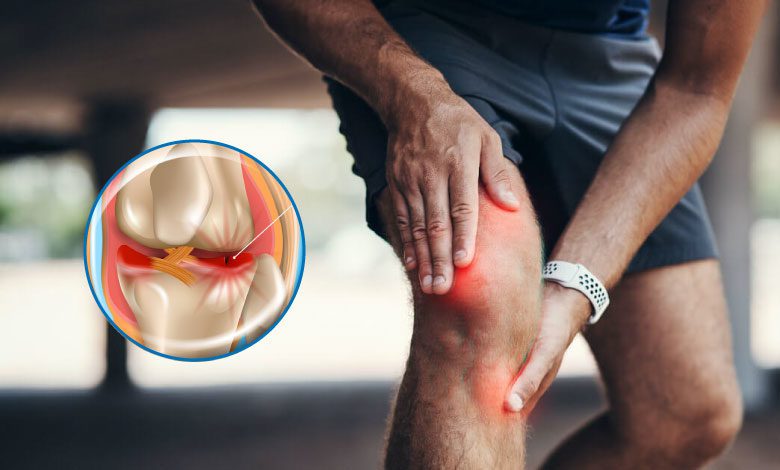 Menisküs yırtığı iyileşir mi, ne iyi gelir? Egzersizleri