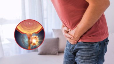 Prostat Kanseri, nedir, neden olur? Belirtileri ve tedavisi