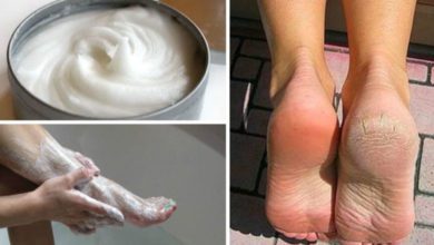 2 günde ayaklardaki nasır ve mantarı temizleyen doğal kür