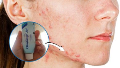 Clindoxyl jel sivilce lekelerine, izlere iyi gelir mi?