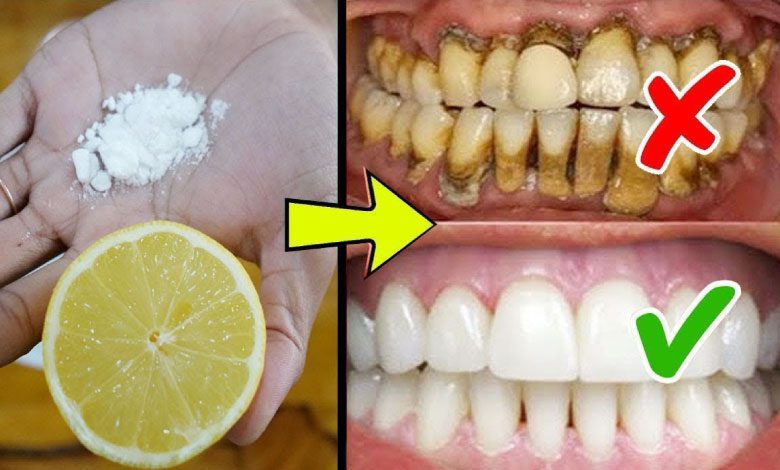 Sarı Dişleri Beyazlatmak İçin Limon