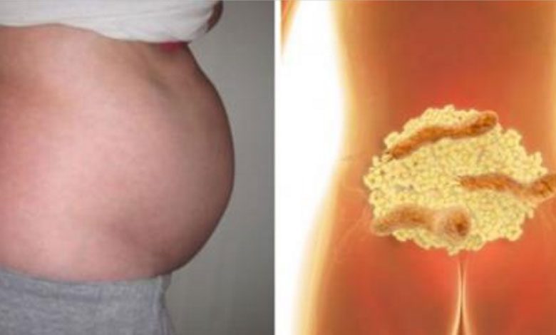 Şişkinlikten nasıl kurtulur ve bir gecede kilo verilir?