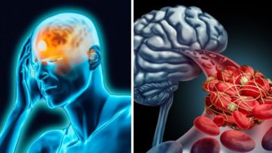 Beyne, akciğere pıhtı atması iyileşme süresi ne kadar?