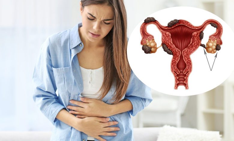 Çikolata kisti patlaması nasıl anlaşılır, patlarsa ne olur?