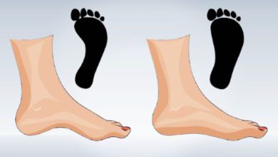 Düz taban ayak askerliğe engel mi?