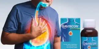 Gaviscon şurup reçetesiz alınır mı, nasıl kullanılır?