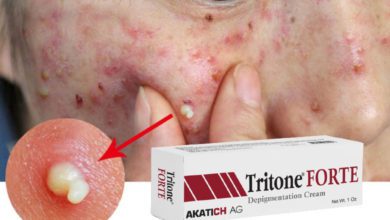 Tritone Forte krem sivilceye iyi gelir mi? İçeriği nedir?