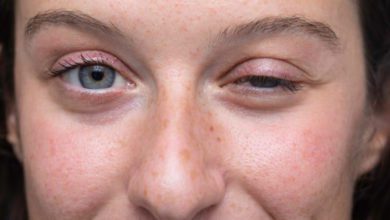 Myastenia gravis nedir, belirtileri nelerdir?