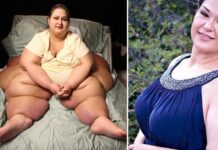 Dünyanın en obez kadını Mayra Rosales'in mucizevi hikayesi