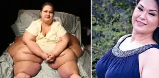 Dünyanın en obez kadını Mayra Rosales'in mucizevi hikayesi