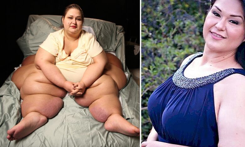 Dünyanın en obez kadını Mayra Rosales'in mucizevi hikayesi