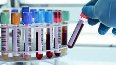 Kan tahlilinde HGB, WBC, LYM, HCT, NEU, MCH nedir?