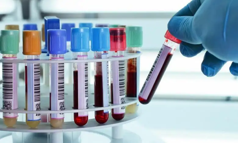 Kan tahlilinde HGB, WBC, LYM, HCT, NEU, MCH nedir? 1 Kan tahlilinde HGB, WBC, LYM, HCT, NEU, MCH nedir?