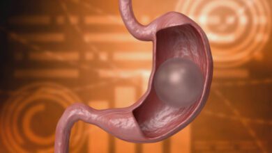 Mide balonu patlarsa ne olur?