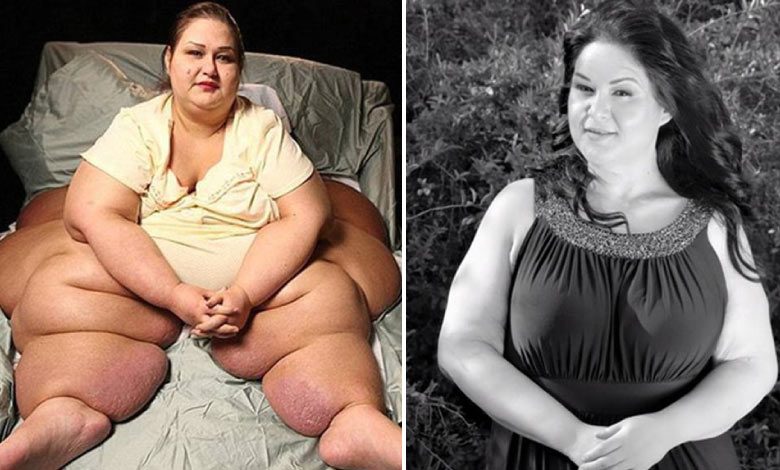 yarim tonluk dunyanin en obez kadini mayra rosalesin mucizevi hikayesi sha 1 Yarım tonluk dünyanın en obez kadını Mayra Rosales'in mucizevi hikayesi