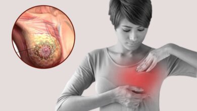 Kadınların görmezden geldiği 10 kanser belirtisi