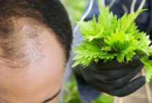 Saç dökülmesine karşı ısırgan otu ile doğal tedavi!