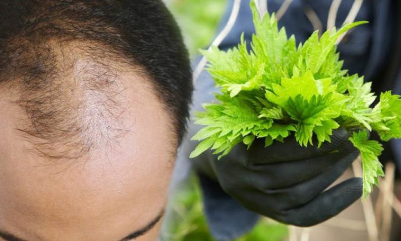 Saç dökülmesine karşı ısırgan otu ile doğal tedavi!