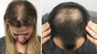 Seyrek saçlar için ne yapılmalı, gürleştirmek için şampuan önerileri