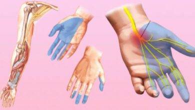 El ve ayak uyuşması neyin belirtisidir?