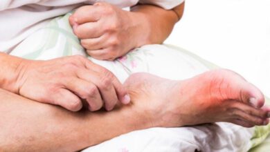 Gut hastalığı nedir, neden olur? Gut hastalığı tedavisi