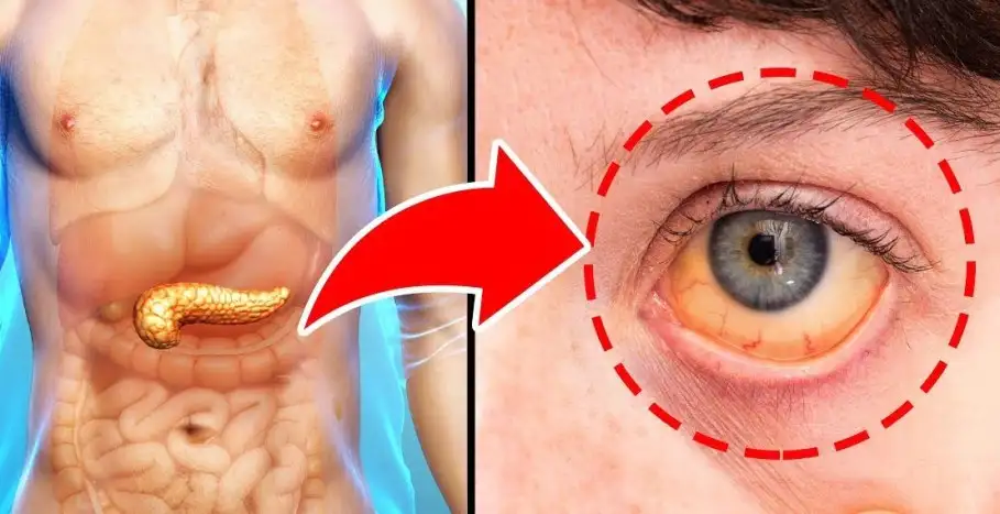 Pankreasınızın sorunlu olduğunun 5 belirtisi