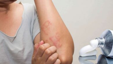 Antimax krem ne işe yarar, ne için kullanılır? Fiyatı
