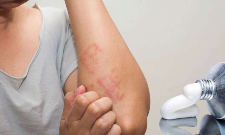 Antimax krem ne işe yarar, ne için kullanılır? Fiyatı