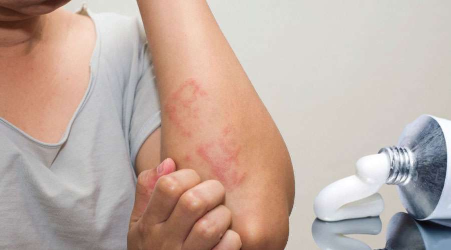 Antimax krem ne işe yarar, ne için kullanılır? Fiyatı