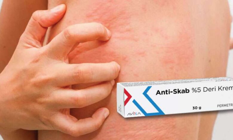 Anti-Skab krem ne işe yarar, uyuza iyi gelir mi? Fiyatı