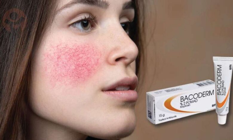 Bacoderm krem yanık için kullanılır mı? Ne işe yarar?