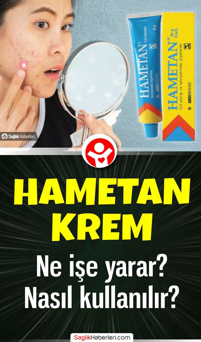 Hametan krem sivilceye, sivilce izlerine iyi gelir mi?