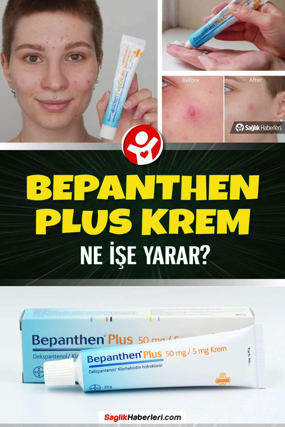 Bepanthen Plus krem ne işe yarar, sivilceye iyi gelir mi?