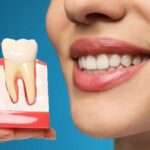 Dental implant tedavisi hakkında bilgi