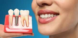 Dental implant tedavisi hakkında bilgi
