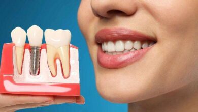 Dental implant tedavisi hakkında bilgi 6 Dental implant tedavisi hakkında bilgi