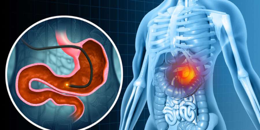 Helikobakter Pilori Nedir? Belirtileri ve Neden Olduğu Hastalıklar