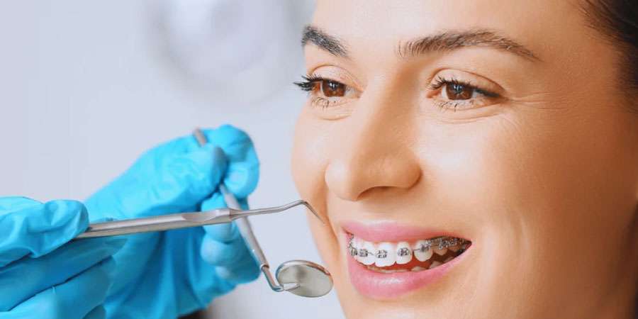 Diş teli fiyatları Alpdent’te taksit avantajı