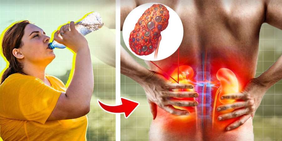 Böbrek sağlığınızı tehdit eden 7 alışkanlık!