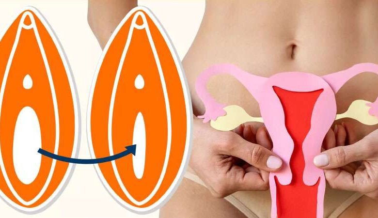 Labioplasti Nedir? Pubis Estetiği ve Vajina Daraltma ile İlgili Her Şey