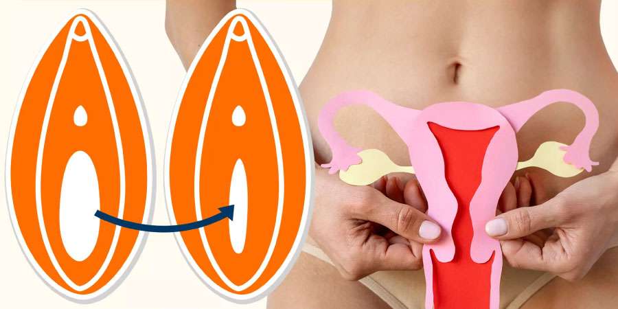 Labioplasti Nedir? Pubis Estetiği ve Vajina Daraltma ile İlgili Her Şey