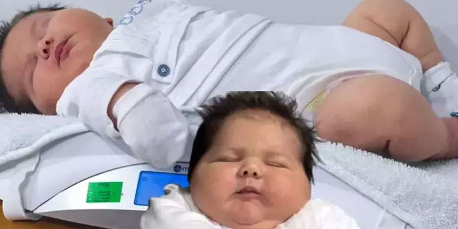 Türkiye’nin En Büyük Bebeği Ali Atilla Literatüre Girmeye Aday!